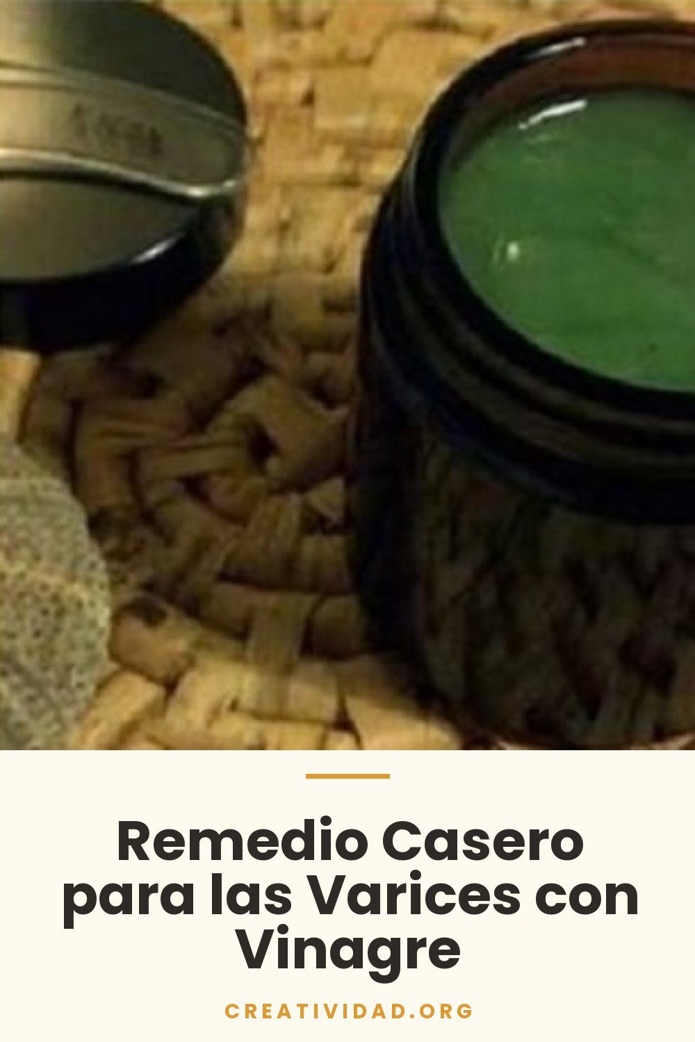 Remedio Casero para las Varices con Vinagre